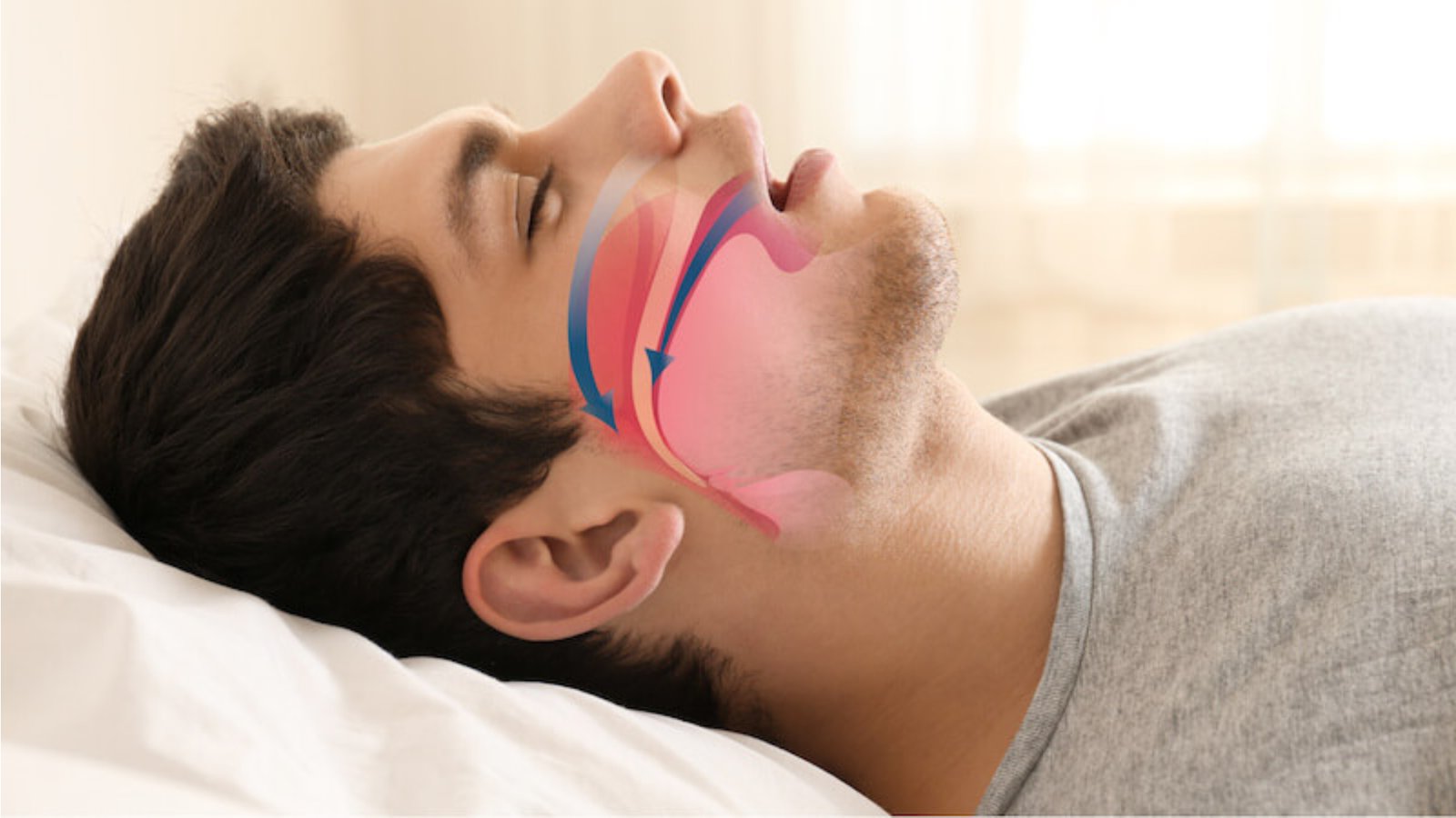 Mouth-Breathing can cause bad breath